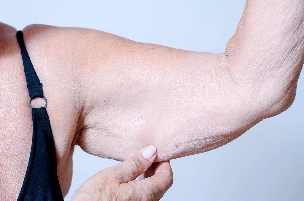 Taxa baixa de massa muscular pode  indicar risco de morte para idosos